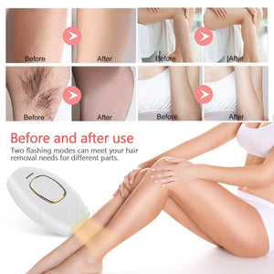 StarMoon Electric IPL Hair Removal